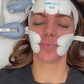 Emface Non-Surgical Facelift