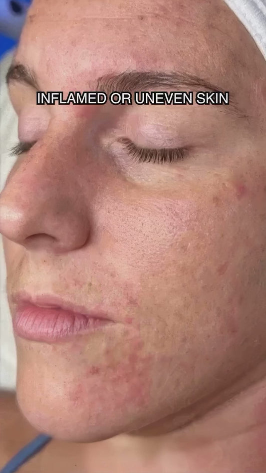 This or That: Skincare Edition! 😌

#renewoklahoma #skincare #skincareroutine #thisorthat #trend