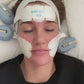 Emface Non-Surgical Facelift