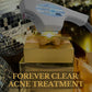 Forever Clear Acne TreatmentProcedure - Renew Wellness & Aesthetics
