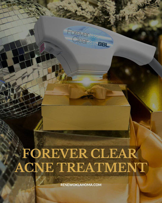 Forever Clear Acne TreatmentProcedure - Renew Wellness & Aesthetics
