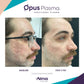 Opus Plasma Laser ResurfacingProcedure - Renew Wellness & Aesthetics