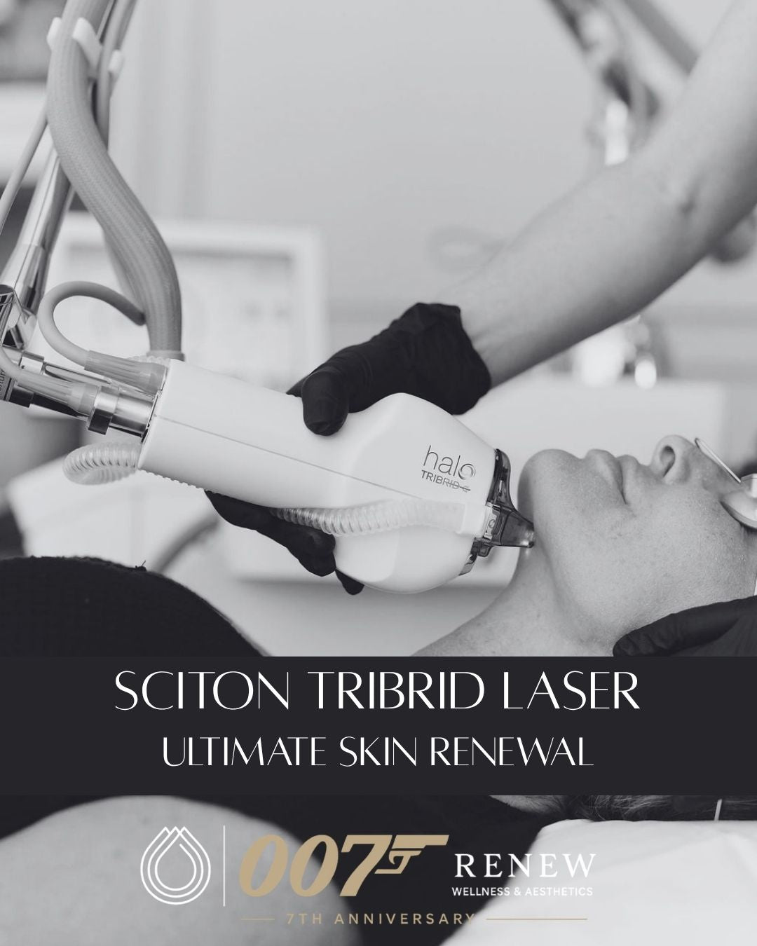 Sciton Tribrid Laser-Ultimate Skin Renewal