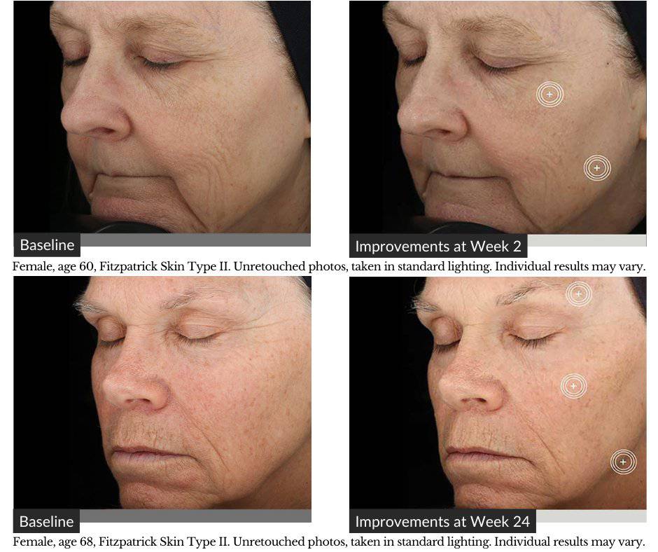 SkinMedica TNS Advanced+ SerumAnti - Aging - Renew Wellness & Aesthetics